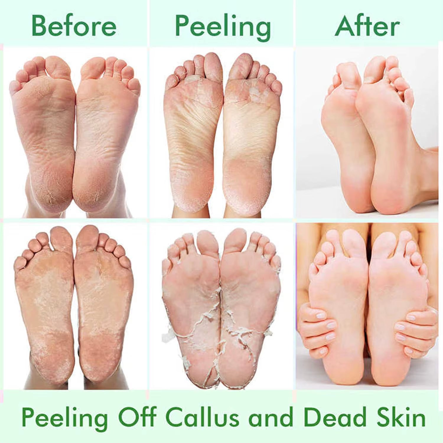 Foot Peel Mask,Exfoliator Peel off Calluses Dead Skin Callus Remover,Foot Mask for Dry Cracked Feet,Foot Peel Mask with Lavende
